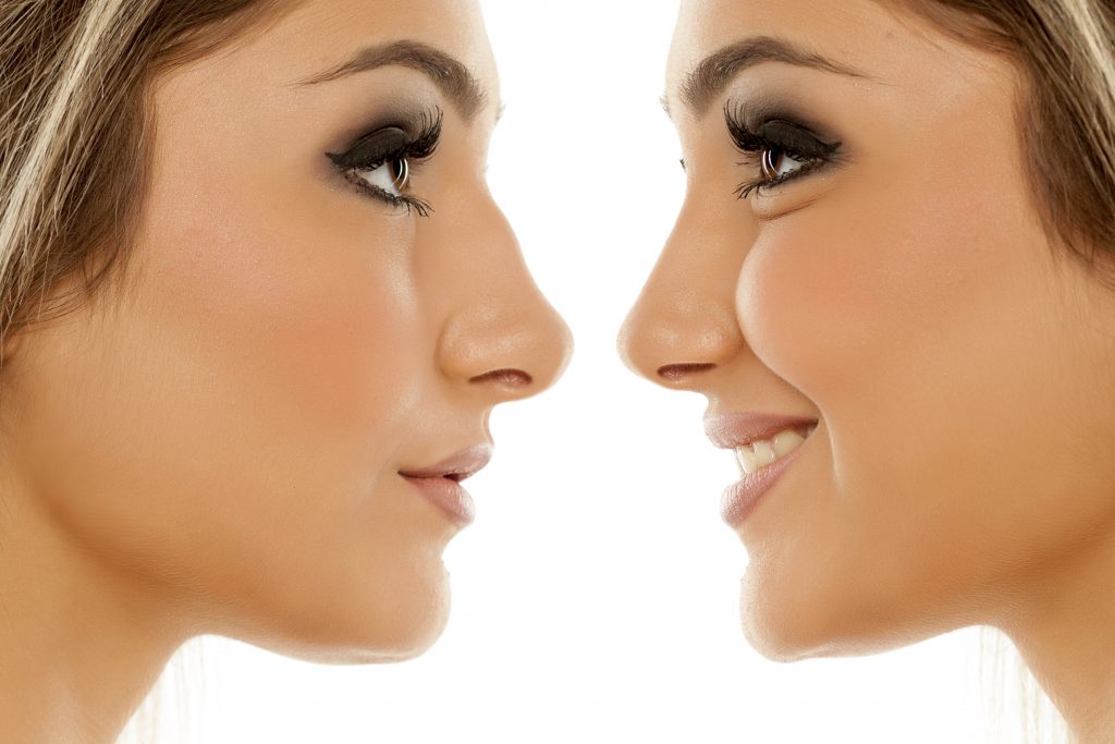 Is a Non-Surgical Nose Job Right For You?