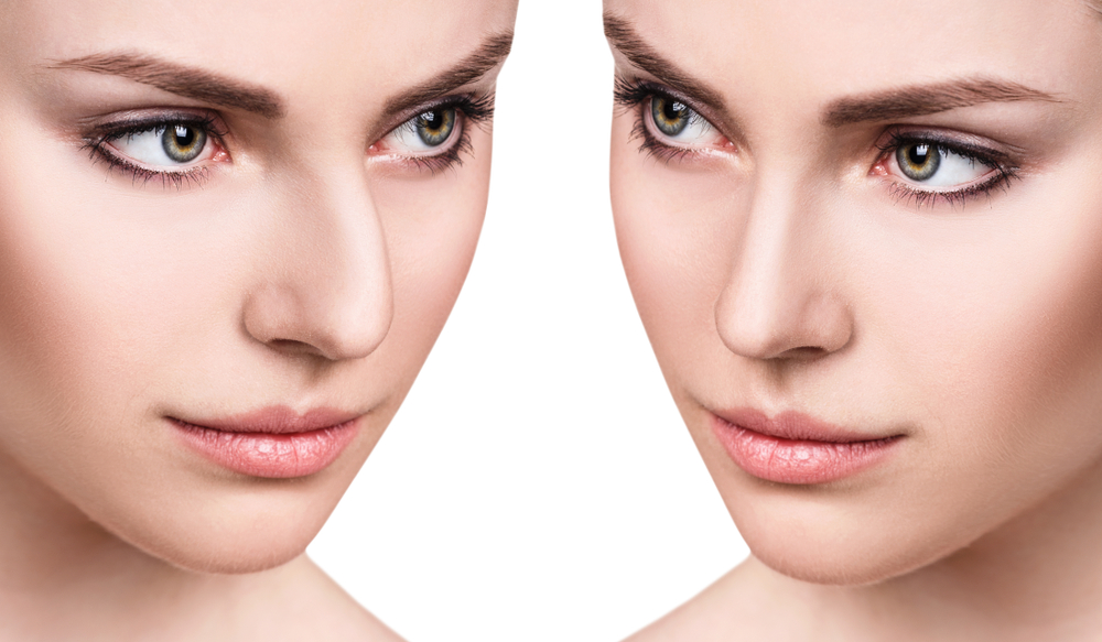 Issues You Should Bring Up With Your Plastic Surgeon Before Your Rhinoplasty