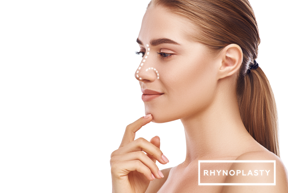 woman's face with rhinoplasty lines overlaid