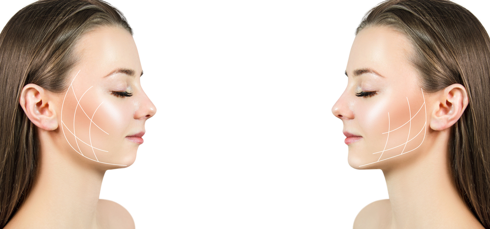 mirror image of woman's face showing facelift contour lines