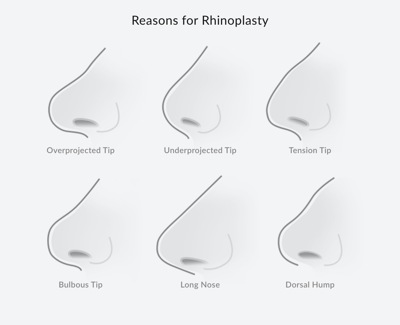 Diagram showing why someone would want to get a rhinoplasty with different nose shapes.