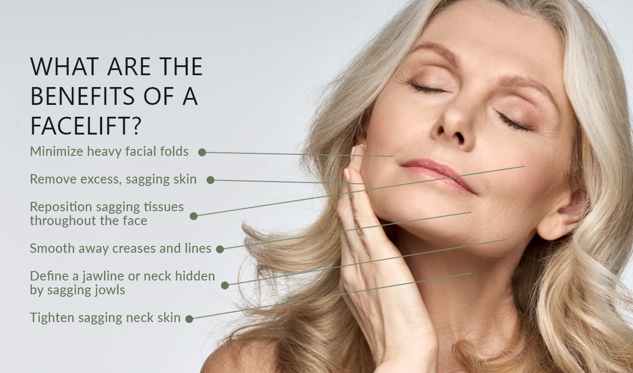 Benefits of a facelift