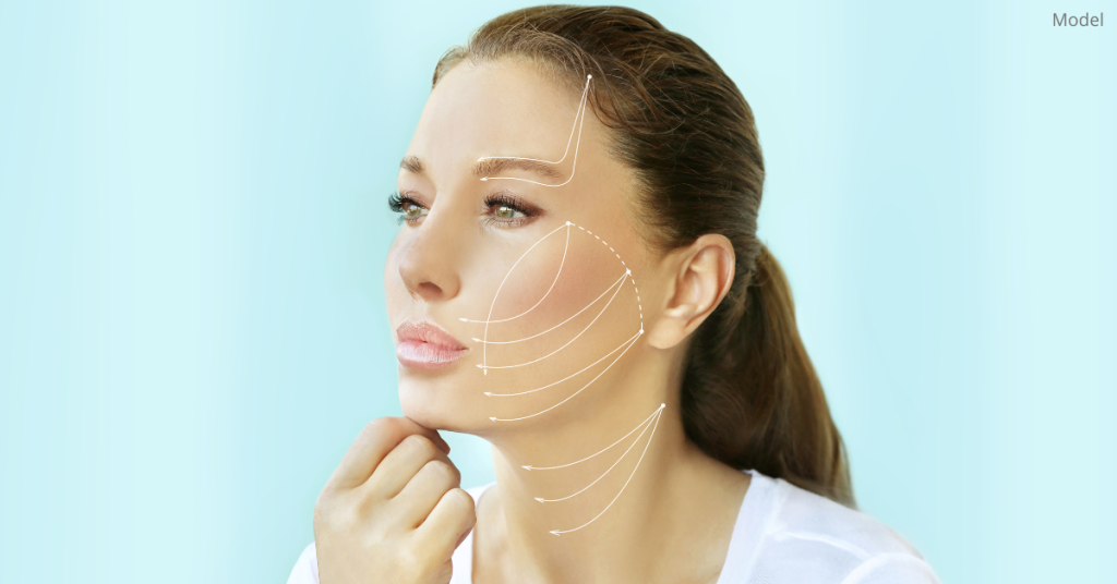 Woman (model) with mock facelift lines drawn over her face.