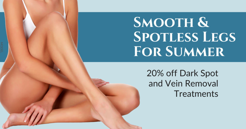 Smooth & Spotless Legs For Summer - 20% off Dark Spot and Vein Removal Treatment. (Model: Woman with beautiful tan legs)