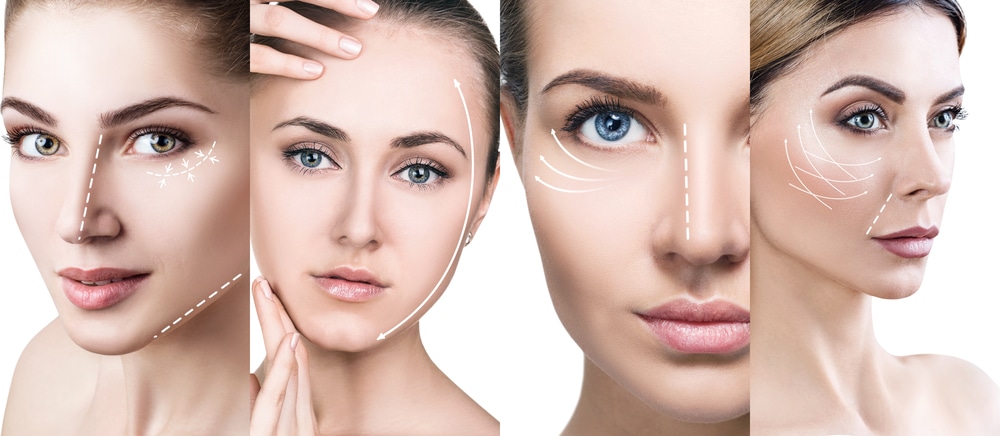 What Is the Difference Between a Facelift, Neck Lift, and Mini Lift?