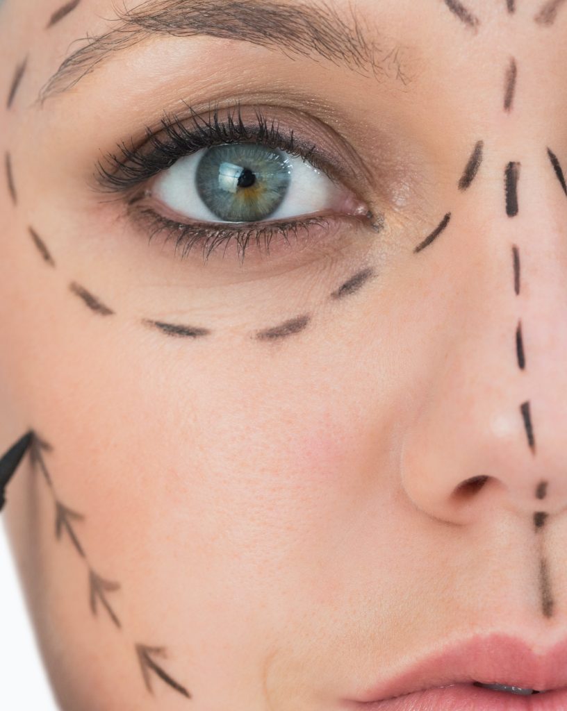 Why the Facelift Is the Gold Standard for Facial Rejuvenation