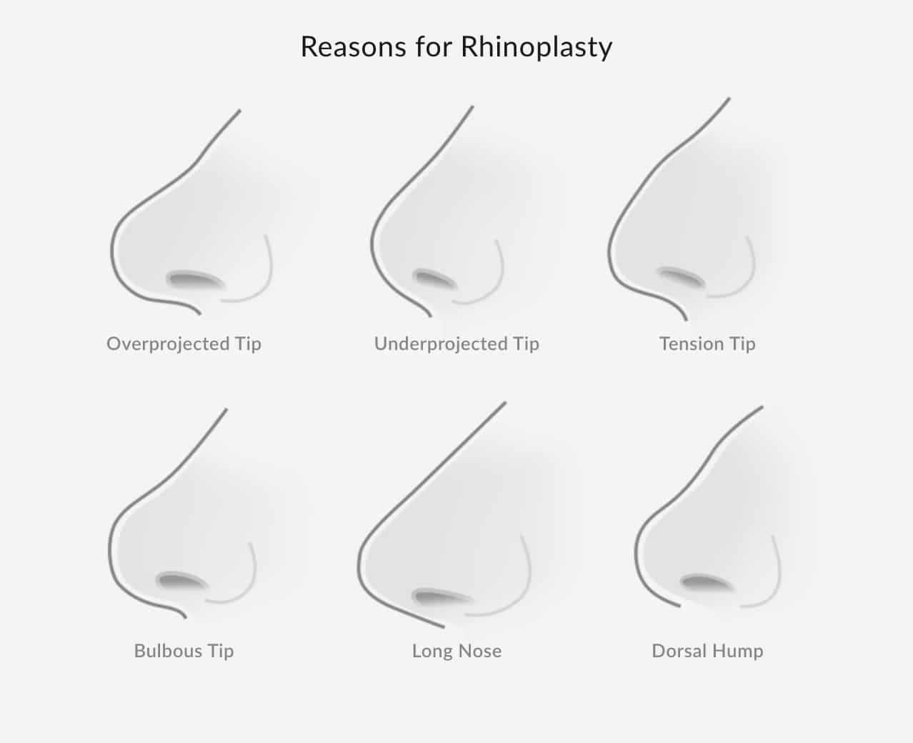 Diagram showing why someone would want to get a rhinoplasty with different nose shapes.