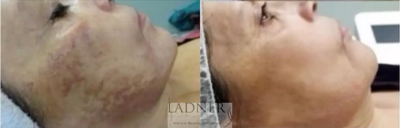 Before and After Image: Skin Treatments - right-side