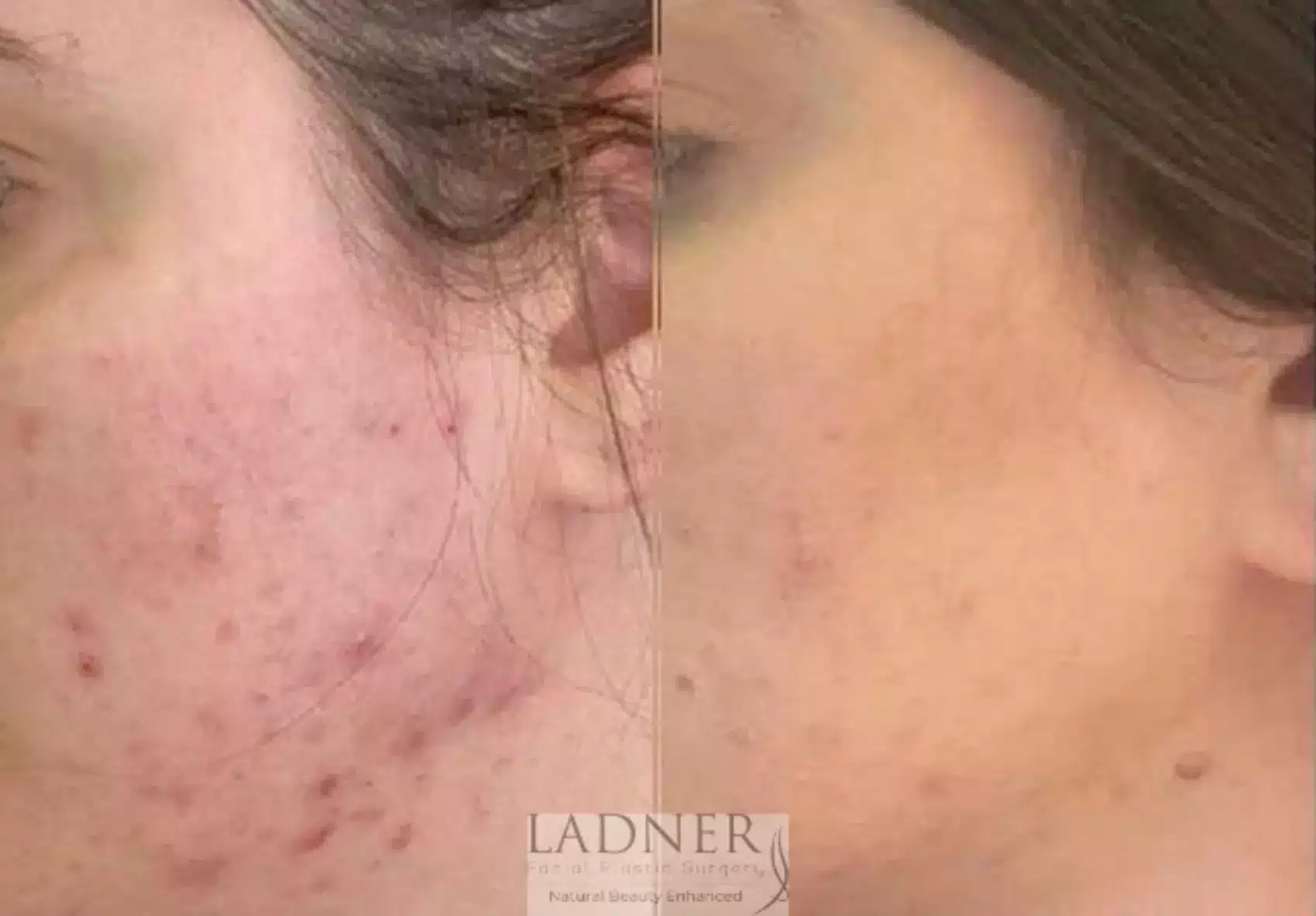Before and After Image: Skin Treatments - left-side