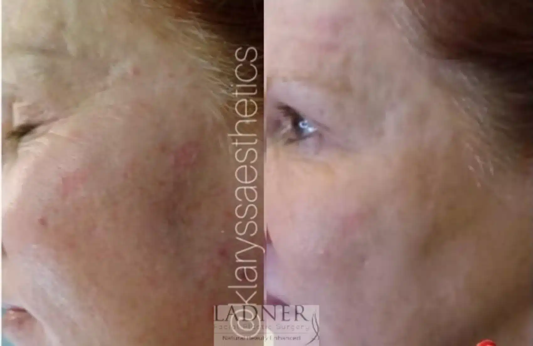 Before and After Image: Skin Treatments - left-side