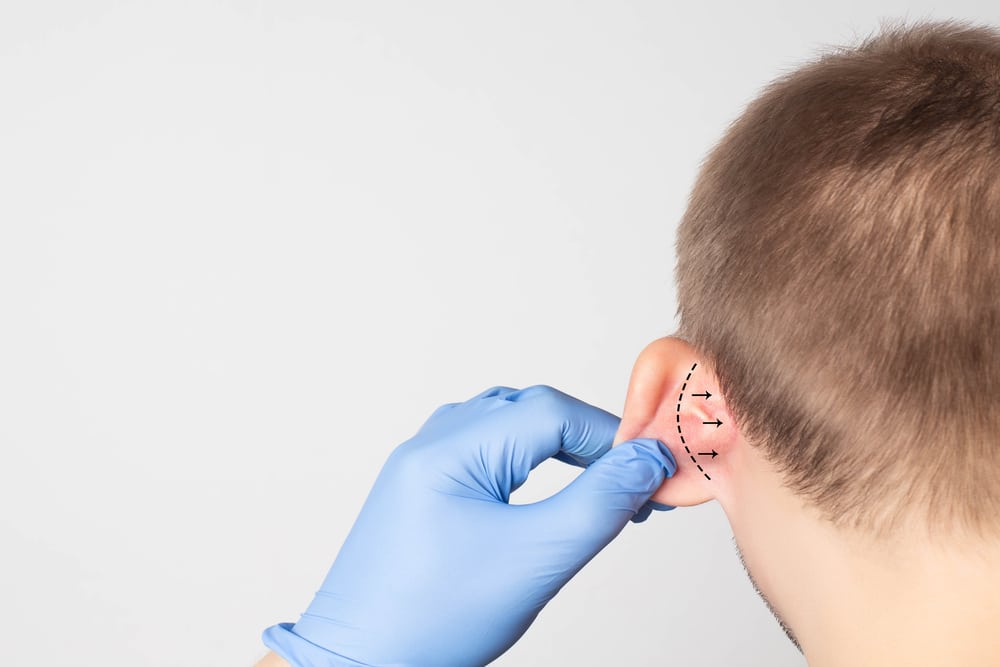 Doctor plans otoplasty on young patient with protruding ears