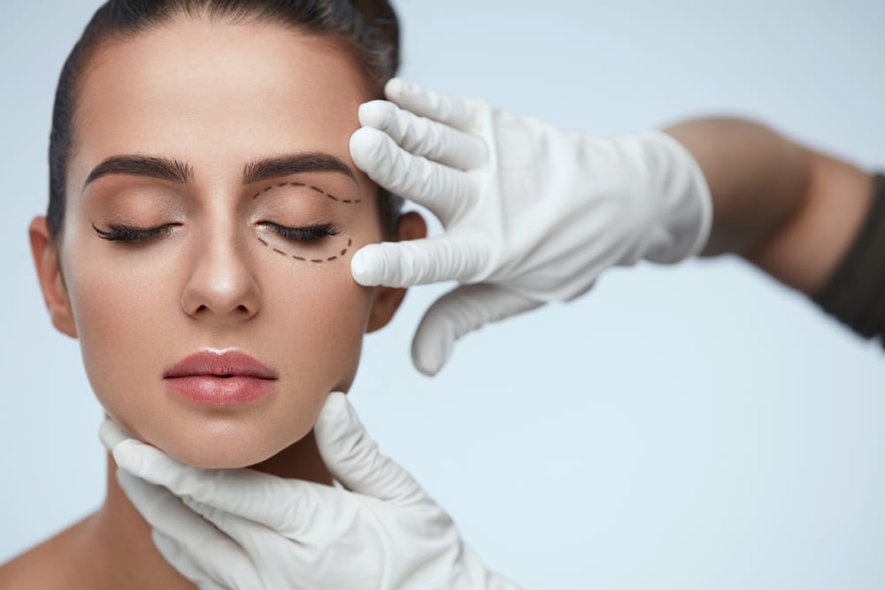 Beautiful young woman having her eyelids drawn on by a facial plastic surgeon in preparation for her blepharoplasty.